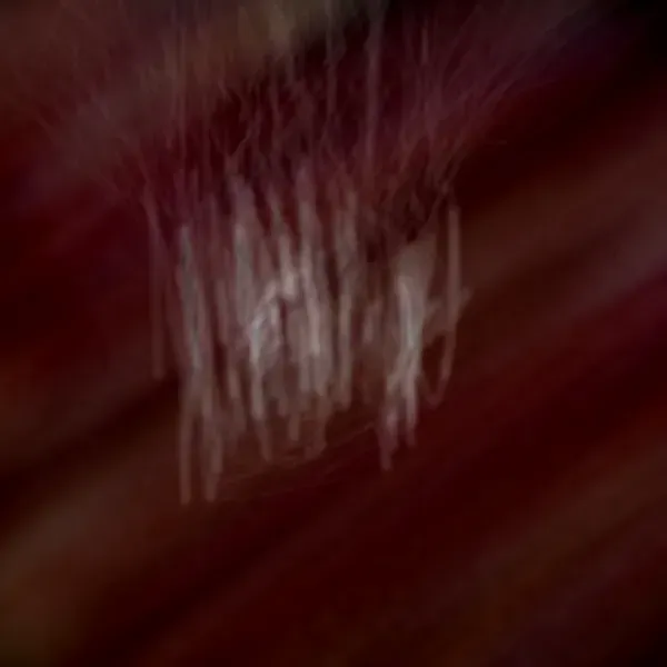 lacuna