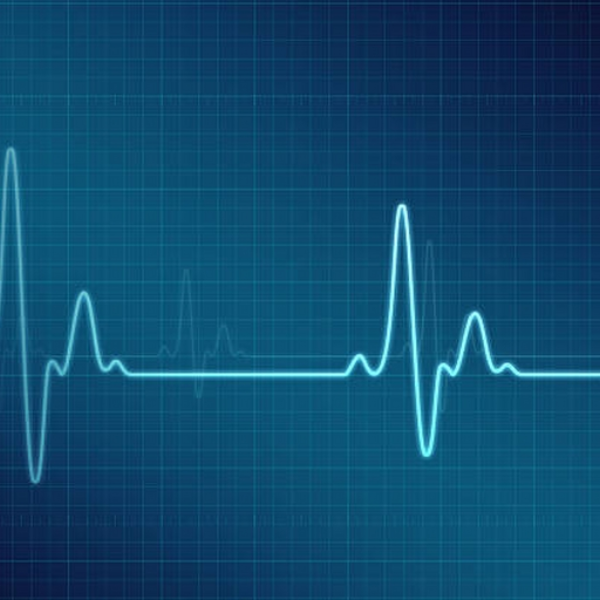 Heart beat