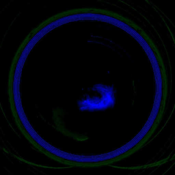 Supermassive Egghole