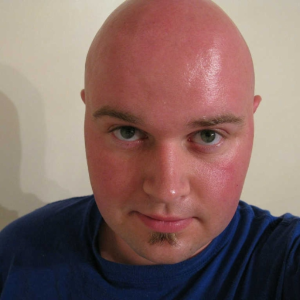 Bald Guy's Head