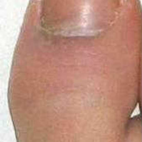Give Me Back My Toe