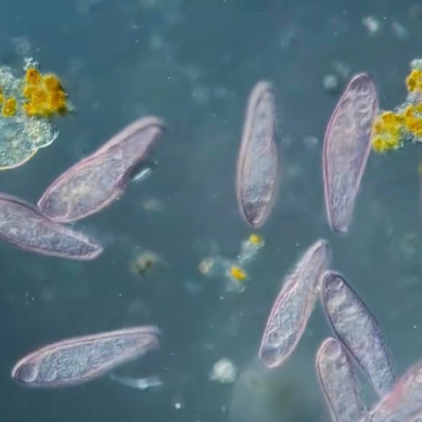 Blepharisma