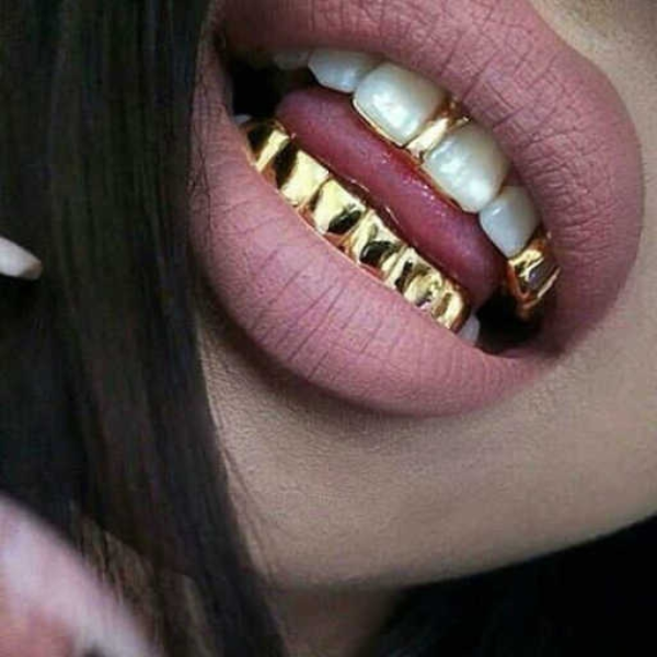 million.are