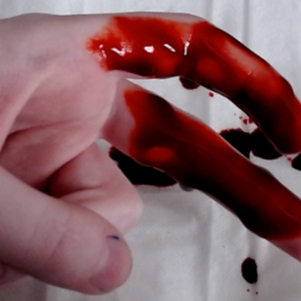 BLOOD?!