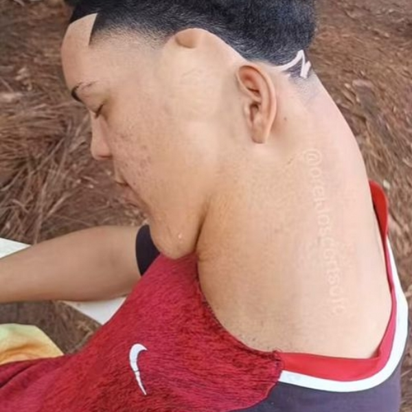 look at my nigga neck bro.