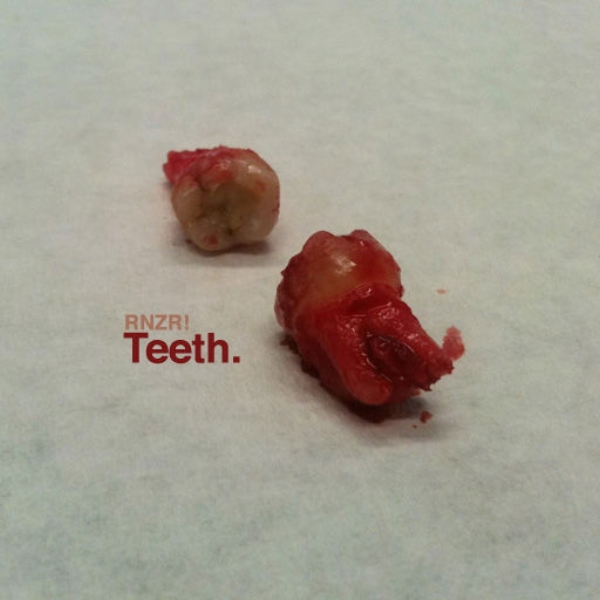 teeth.