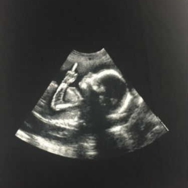That Boy