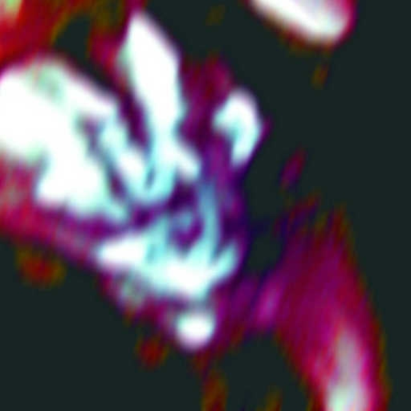 The End (Tajunta Remix)