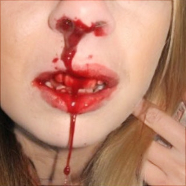 BB