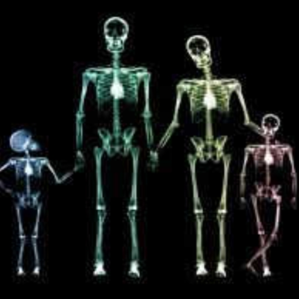 X-ray