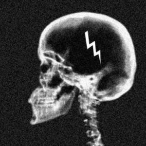 X RAY
