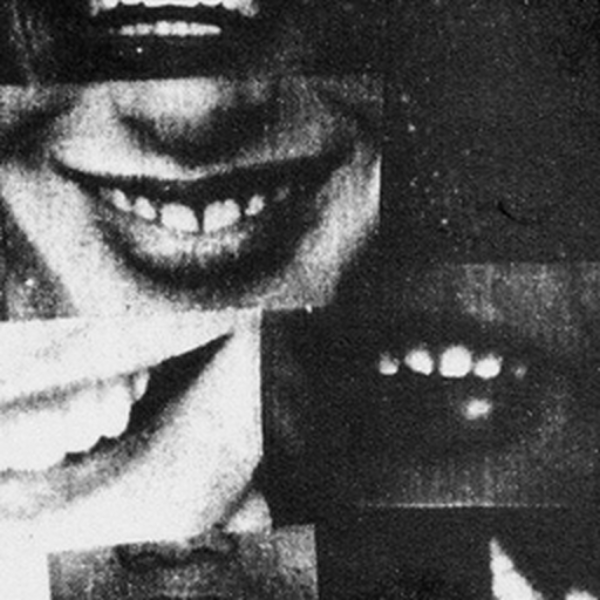 SEDATED