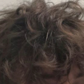 AARXNXLT