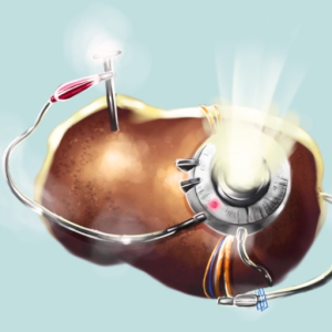GladosPotato