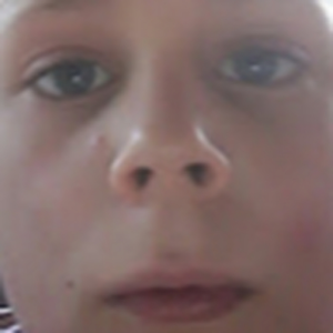 ervs