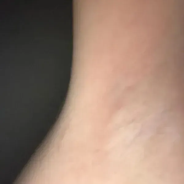 hairyarmpit
