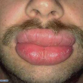 kissme