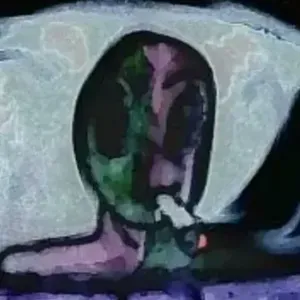 NoPerception