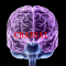 Cranial